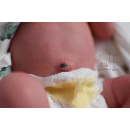 Tummy plate and umbilical cord for Gracie Mae by LLE (PRE-ORDER)